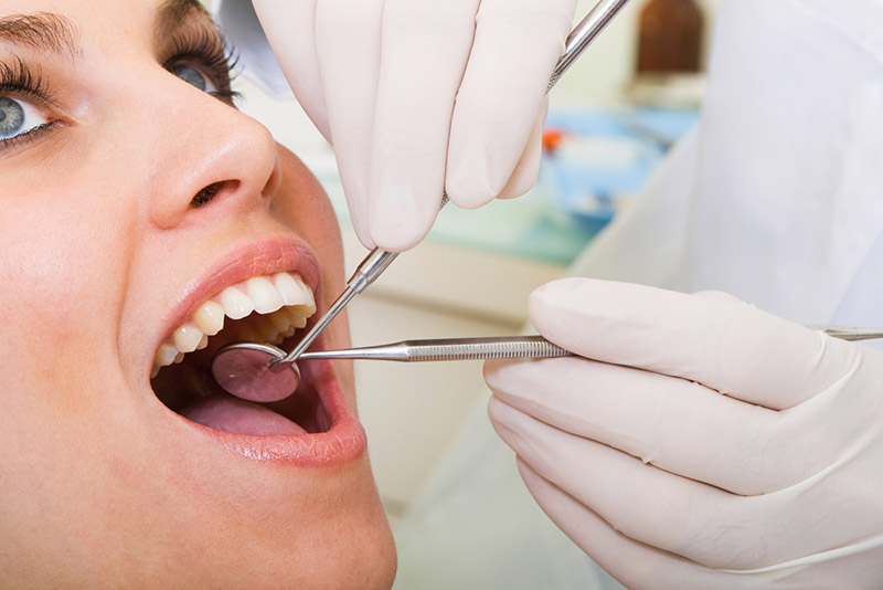 composite fillings in south edmonton