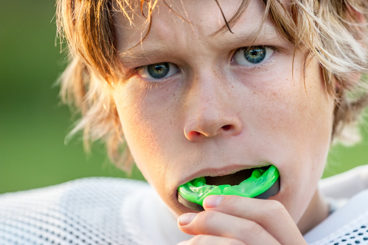 importance of using custom mouthguards in sports