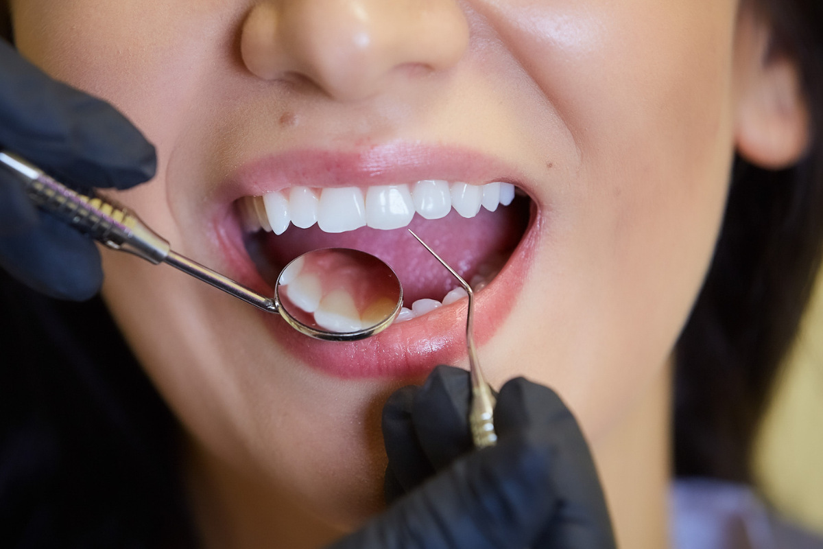 why do you need a regular dental check-up