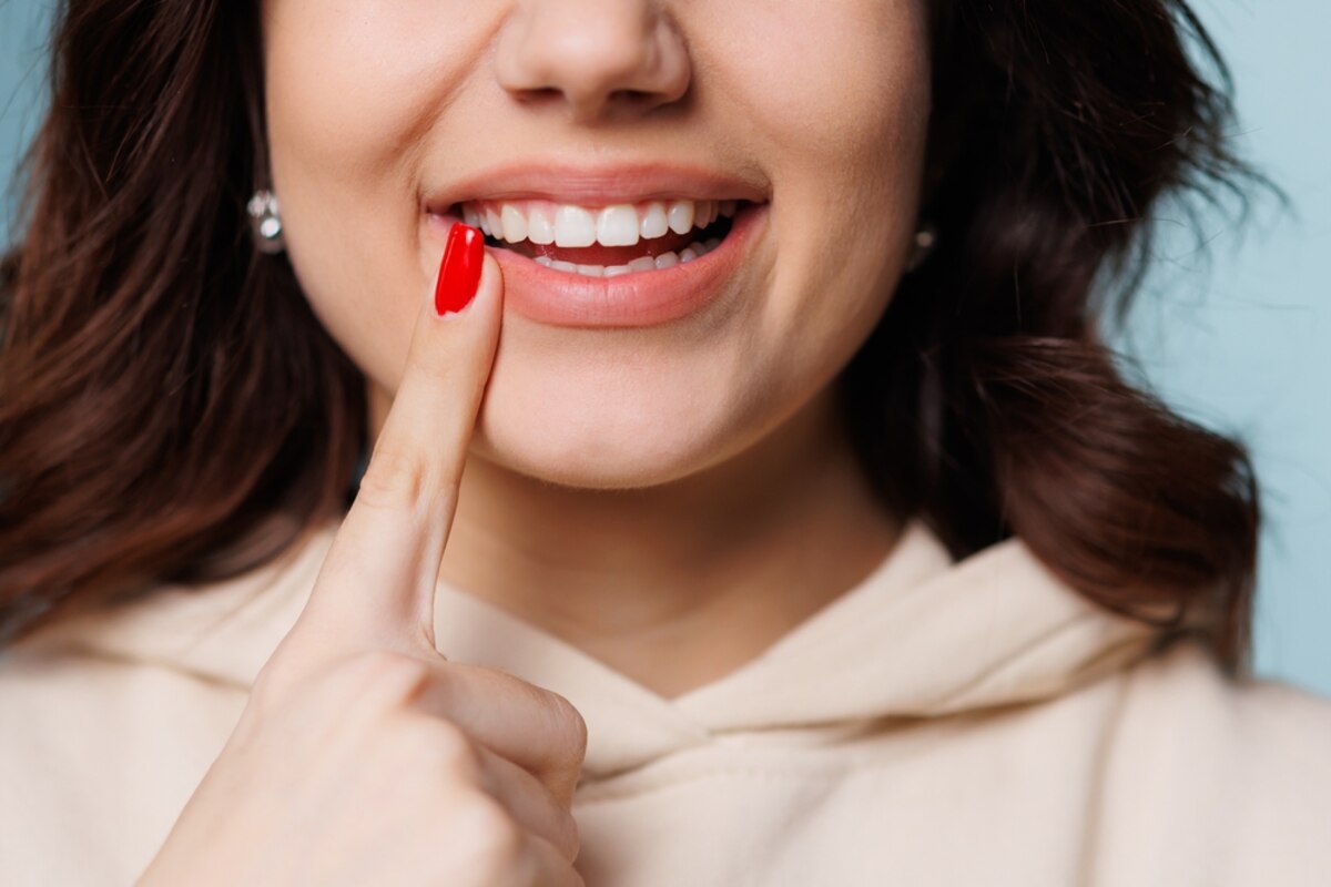 the best teeth whitening options for different types of stains
